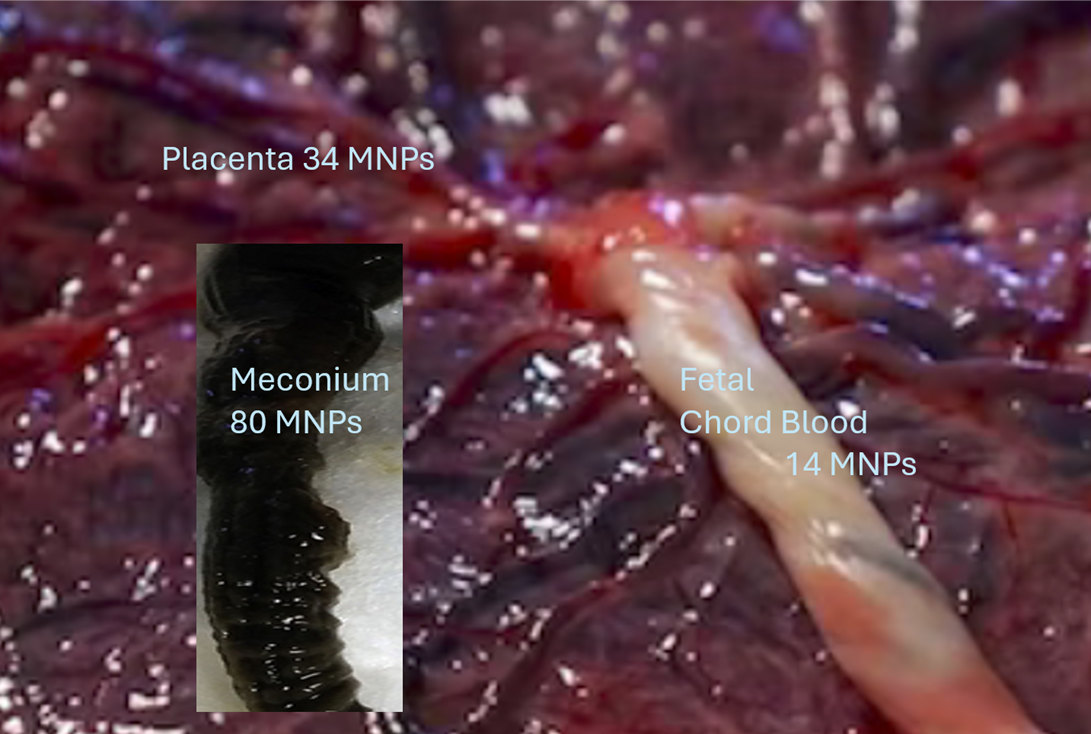 A close up of a body

AI-generated content may be incorrect.